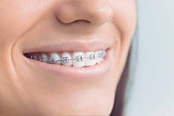 Best Wisdom Tooth Removal  in East Peoria, IL